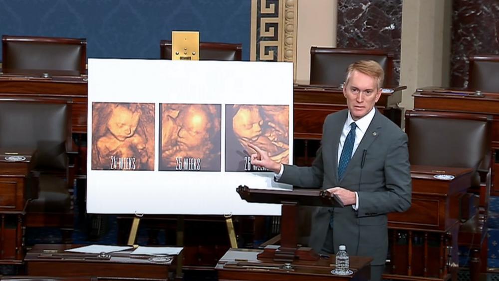 "Це дитина?" - Сенатор США показав фото ненародженої дитини та виступив з шокуючою промовою